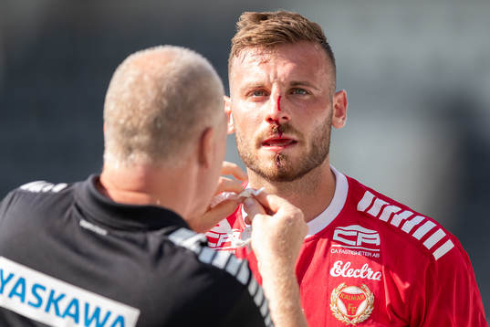 Kalmars Fidan Aliti blöder från näsan
