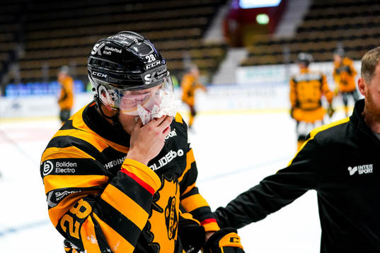 Skellefteås Jesper Frödén fick en klubba i ansiktet och