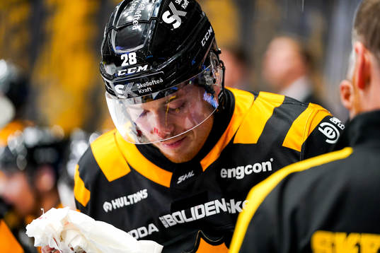 Skellefteås Jesper Frödén fick en klubba i ansiktet och