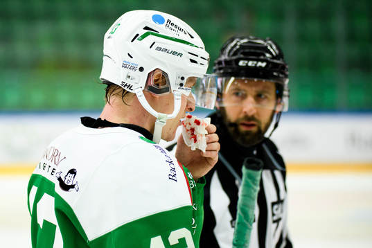 Rögles Olli Palola har ont