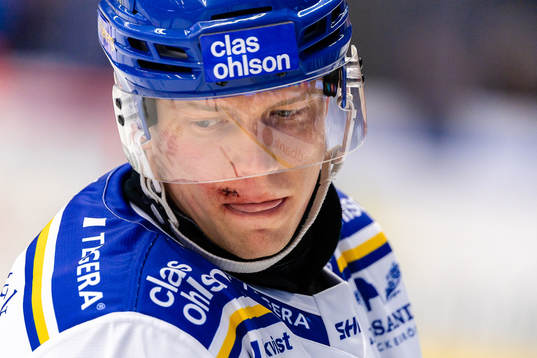 Leksands Patrik Zackrisson med sydd läpp