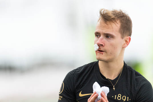 s Saku Ylätupa blöder från näsan
