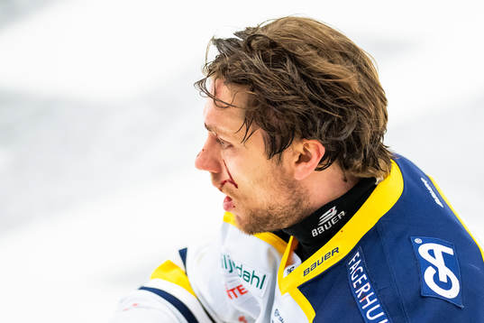 s Eric Martinsson blöder ifrån ansiktet