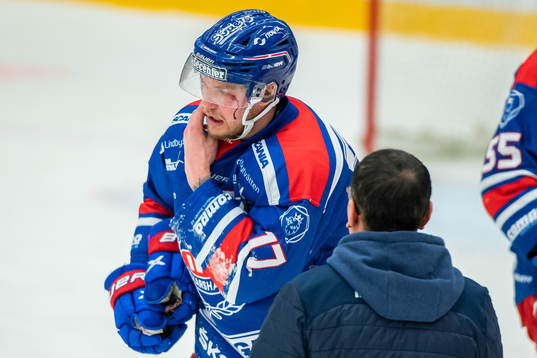 Oskarshamns Jonas Engström blöder från ansiktet