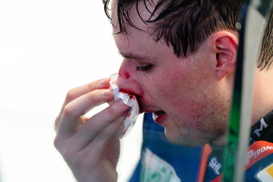 Växjös Brendan Gaunce blöder från näsan