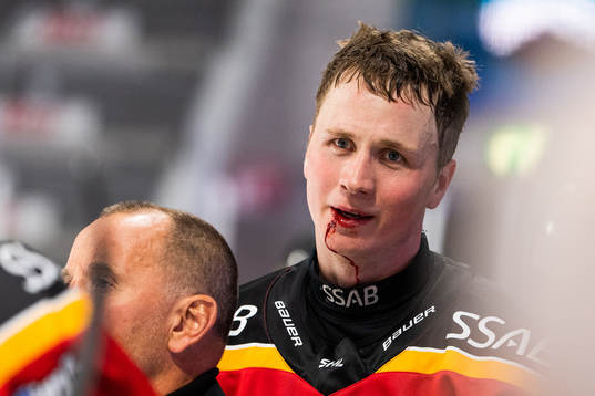 Luleås Jonas Berglund blöder från munnen