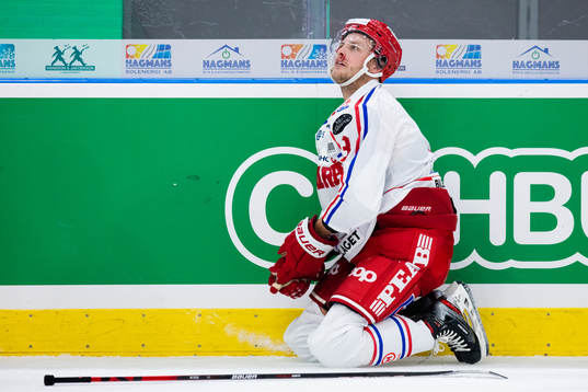 Timrås Oliver Bohm blöder i ansiktet