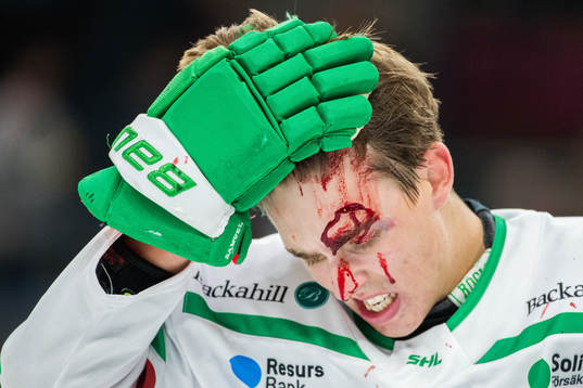 Rögles Samuel Johannesson blöder