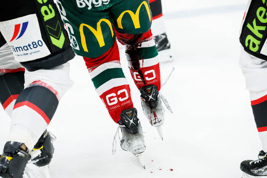 Frölundas Max Friberg blöder från benet