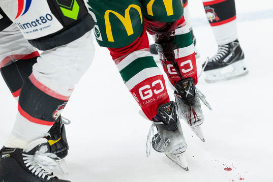 Frölundas Max Friberg lämnar isen blödande
