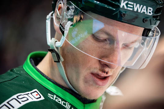 Färjestads Gustav Rydahl har sytt överläppen
