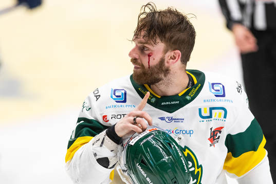 Björklövens Charles David Beaudoin blöder från ansiktet