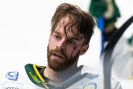 Björklövens Charles David Beaudoin blöder från ansiktet