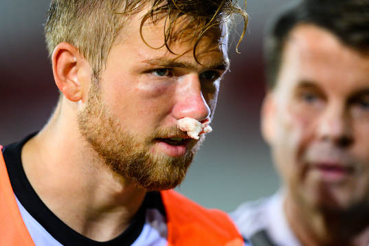 Örebros Niclas Bergmark har näsblod