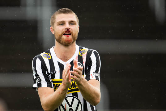 Landskronas Erik Hedenquist  med blodig näsa