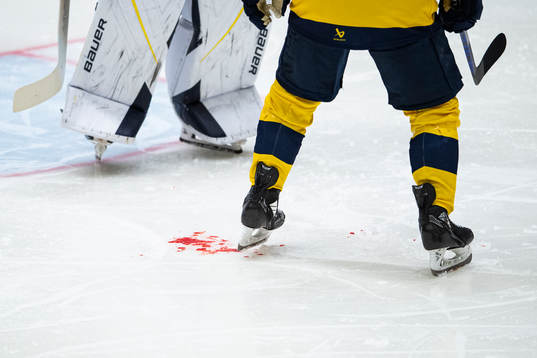 s Emil Andrae ha träffas av en puck i ansiktet