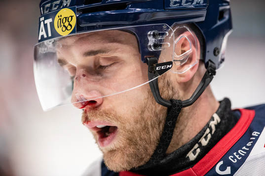 Linköpings Patrick Russell har ont