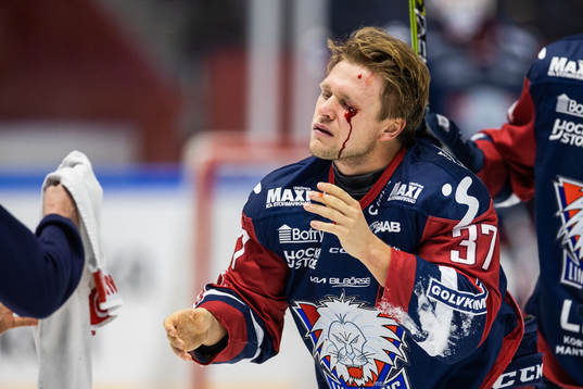 Linköpings Jesper Pettersson blöder från ögat