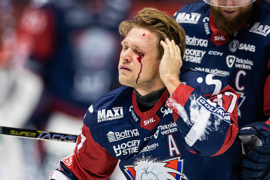 Linköpings Jesper Pettersson blöder från ögat