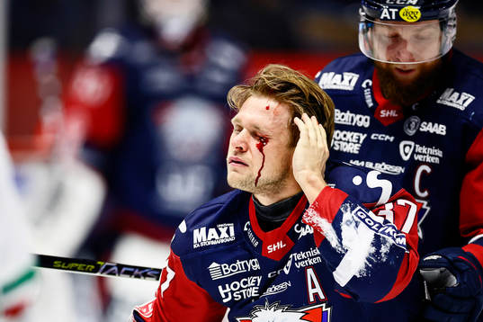 Linköpings Jesper Pettersson skadad vid ögat