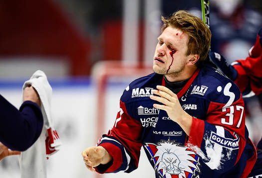 Linköpings Jesper Pettersson skadad vid ögat