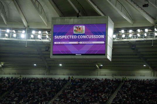 The media screen displaying a substitution as an affect of