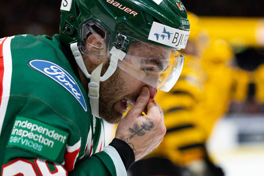 Frölundas Anthony Greco blöder från näsan