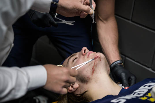 Leo Carlsson of Sweden getting stitched up