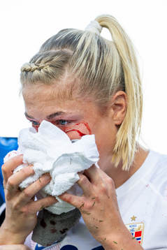 Sophie Román Haug of Norway in pain