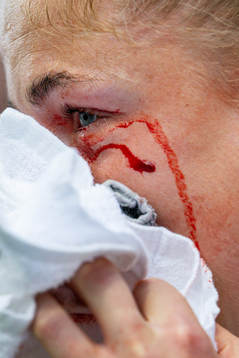 Sophie Román Haug of Norway in pain
