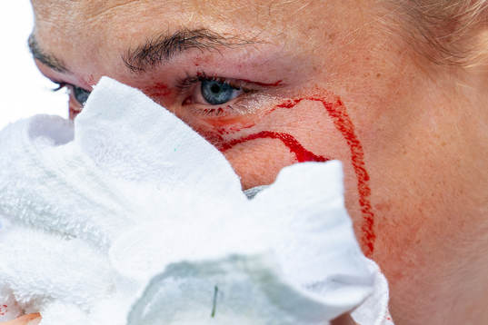 Sophie Román Haug of Norway in pain