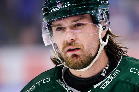Färjestads Linus Johansson blöder från munnen