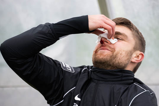 Landskronas Erik Hedenquist näsblöder