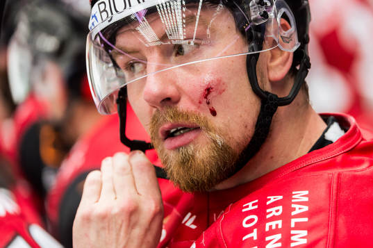 Malmö Redhawks Johan Ivarsson har ont