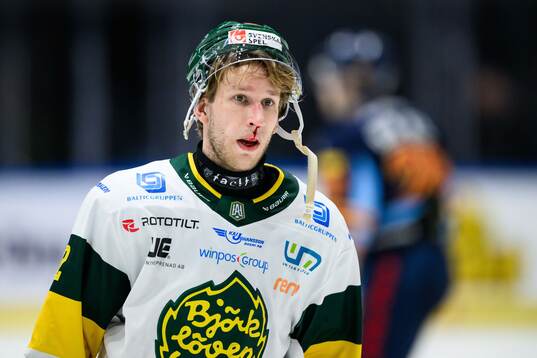 Björklövens Fredric Weigel blöder från näsan