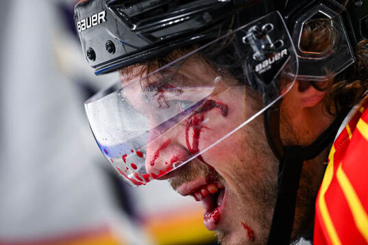 Brynäs Tyler Kelleher har ont