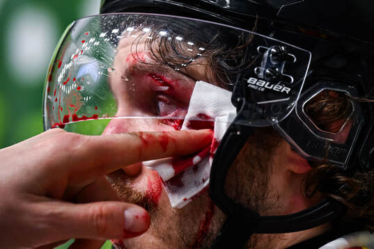 Brynäs Tyler Kelleher har ont