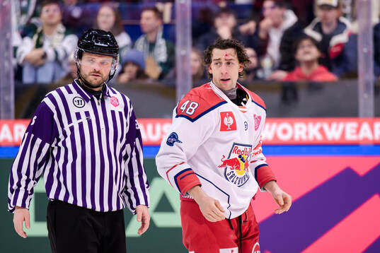 Lucas Thaler of EC Red Bull Salzburg is bleeding from the