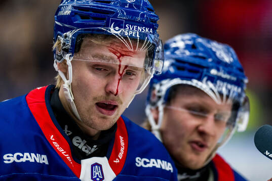 Oskarshamns Hampus Karlsson blöder