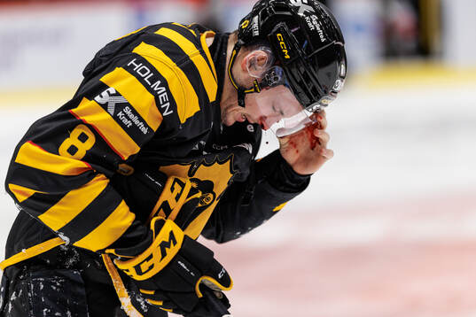 Skellefteås Oliver Okuliar har ont
