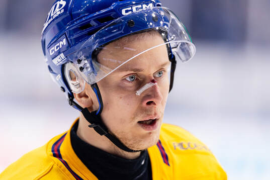 Djurgårdens Jesse Ylönen med plåster