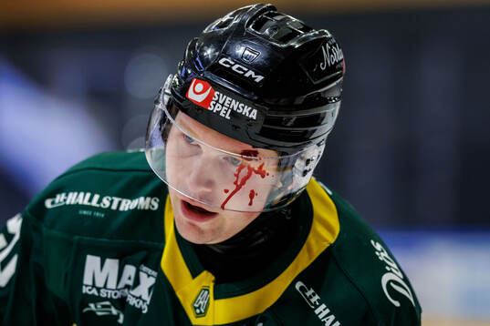 Östersunds Carl Holmner-Härgestam har ont