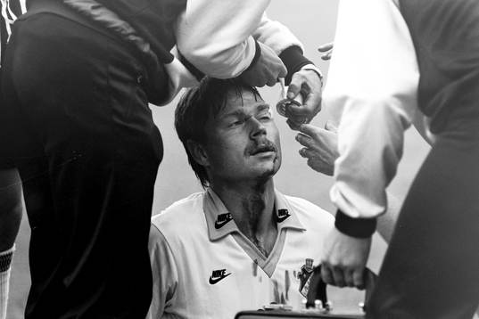 Sven Dahlkvist, AIK har spräckt sitt ögonbryn och får
