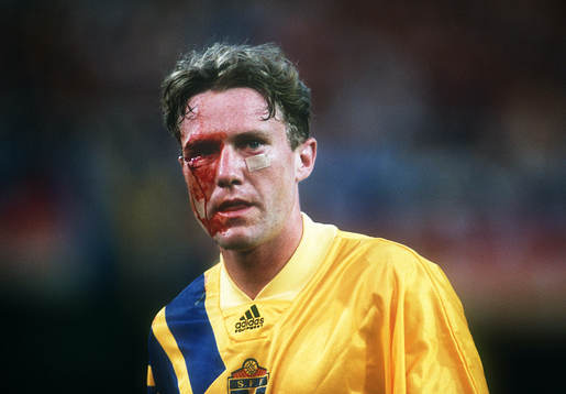 Jan Eriksson blöder