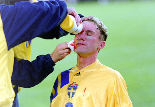 Jan Eriksson of Sweden gets medical attention