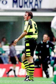 Malcolm Mackay, Celtic har fått en smäll i huvudet