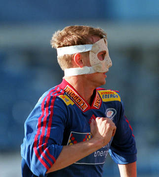 Brutet näsben (bandage, ansiktsmask, mask, nässkydd,