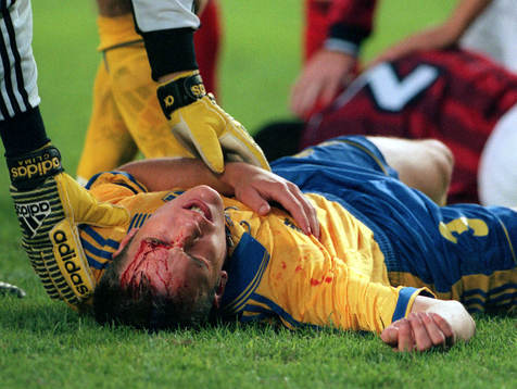 Patrik Andersson (Patrik Bjärred   Andersson)